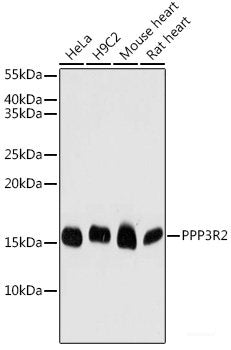 Immunohistochemistry of paraffin-embedded Rat ovary using MAP2K3 Polyclonal Antibody at dilution of  1:100 (40x lens).