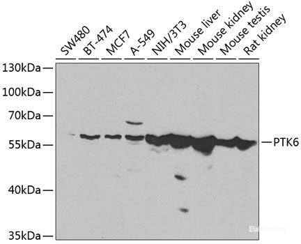 Immunohistochemistry of paraffin-embedded Rat heart using PSEN2 Polyclonal Antibody at dilution of  1:100 (40x lens).