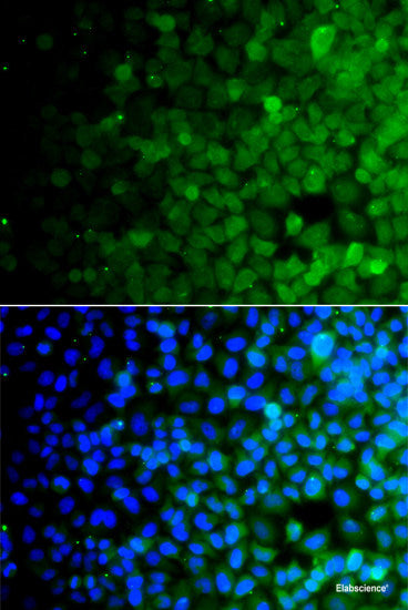 Immunohistochemistry of paraffin-embedded Rat kidney using SHC1 Polyclonal Antibody at dilution of  1:100 (40x lens).