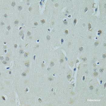 Immunohistochemistry of paraffin-embedded Rat kidney using SHH Polyclonal Antibody at dilution of  1:100 (40x lens).