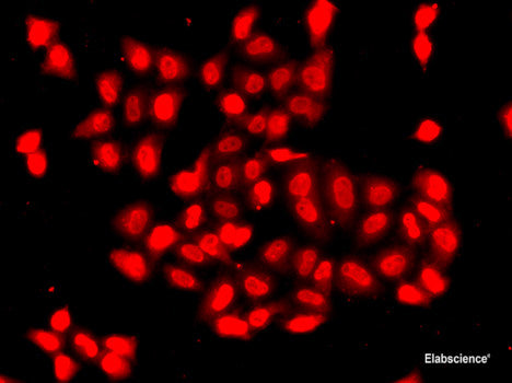 Immunohistochemistry of paraffin-embedded Mouse liver using SSX5 Polyclonal Antibody at dilution of  1:100 (40x lens).