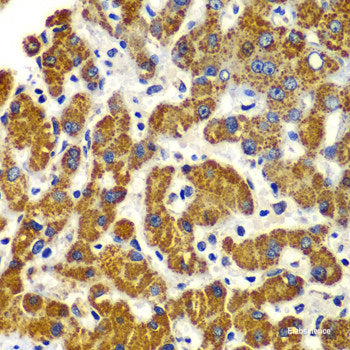 Immunohistochemistry of paraffin-embedded Human stomach using SYT4 Polyclonal Antibody at dilution of  1:100 (40x lens).