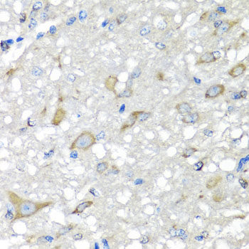 Immunohistochemistry of paraffin-embedded Human prostate using NCK2 Polyclonal Antibody at dilution of  1:100 (40x lens).