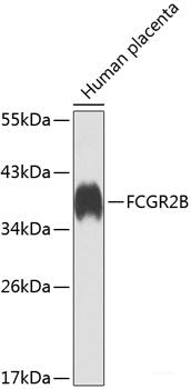 Western blot analysis of extracts of various cell lines using SQSTM1 / p62 Polyclonal Antibody at dilution of 1:1000.