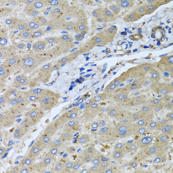 Immunofluorescence analysis of A549 cells using ARPC3 Polyclonal Antibody