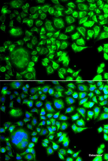 Immunofluorescence analysis of A549 cells using RRAGA Polyclonal Antibody