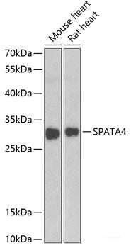 Western blot analysis of extracts of various cell lines using HARS2 Polyclonal Antibody at dilution of 1:1000.
