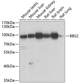 Immunofluorescence analysis of U2OS cells using ATP5F1 Polyclonal Antibody at dilution of  1:100. Blue: DAPI for nuclear staining.