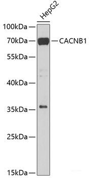 Western blot analysis of extracts of various cell lines using EPS15L1 Polyclonal Antibody at dilution of 1:1000.