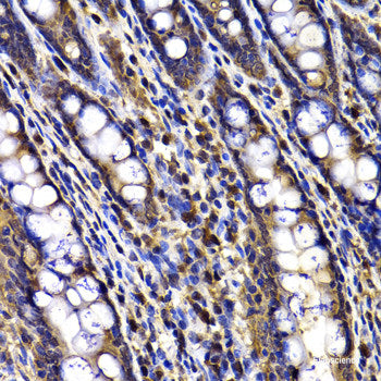 Immunofluorescence analysis of U2OS cells using HAUS8 Polyclonal Antibody at dilution of  1:100. Blue: DAPI for nuclear staining.
