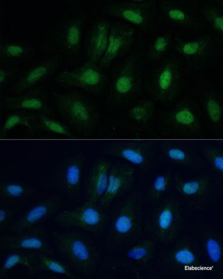 Immunohistochemistry of paraffin-embedded Human liver damage using SMAD9 Polyclonal Antibody at dilution of  1:100 (40x lens).
