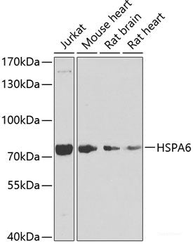 Immunohistochemistry of paraffin-embedded Rat ovary using ACAT2 Polyclonal Antibody at dilution of  1:100 (40x lens).
