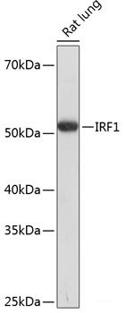 Immunohistochemistry of paraffin-embedded Rat spleen using ADAR Polyclonal Antibody at dilution of  1:100 (40x lens).
