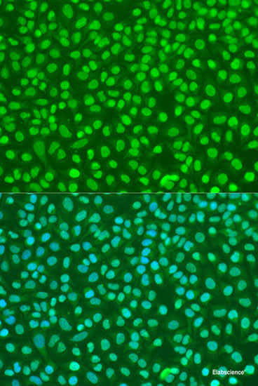 Western blot analysis of extracts of A-549 cells using ATP1A1 Polyclonal Antibody at dilution of 1:1000.