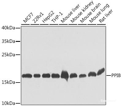 Immunohistochemistry of paraffin-embedded Rat brain using CDH16 Polyclonal Antibody at dilution of  1:100 (40x lens).