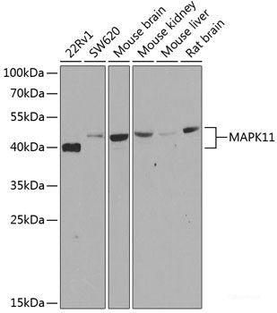 Immunofluorescence analysis of U2OS cells using EIF2B1 Polyclonal Antibody at dilution of  1:100. Blue: DAPI for nuclear staining.