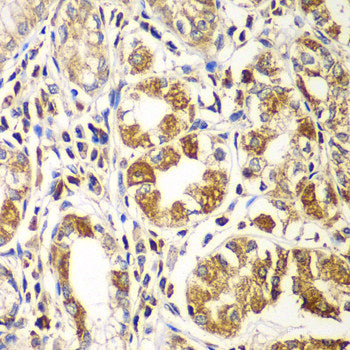 Immunohistochemistry of paraffin-embedded Human colon muscle using FLNA Polyclonal Antibody at dilution of  1:100 (40x lens).