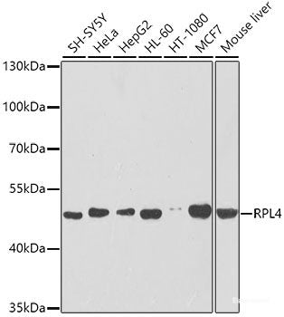 Immunofluorescence analysis of HeLa cells using TRIM13 Polyclonal Antibody