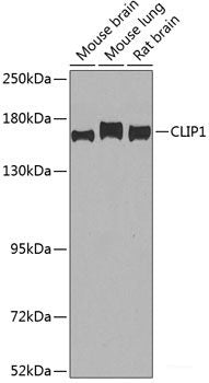 Western blot analysis of extracts of BT-474 cells using GTF2I Polyclonal Antibody at dilution of 1:500.