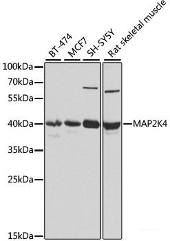 Immunohistochemistry of paraffin-embedded Rat brain using HTT Polyclonal Antibody at dilution of  1:100 (40x lens).