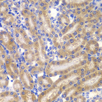 Immunohistochemistry of paraffin-embedded Human gastric using HRas Polyclonal Antibody at dilution of  1:100 (40x lens).