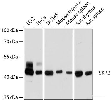 Immunofluorescence analysis of U2OS cells using IFNA6 Polyclonal Antibody at dilution of  1:100. Blue: DAPI for nuclear staining.