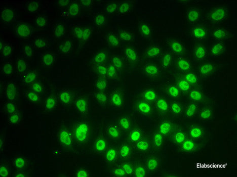 Immunohistochemistry of paraffin-embedded Rat brain using FASTKD1 Polyclonal Antibody at dilution of  1:100 (40x lens).