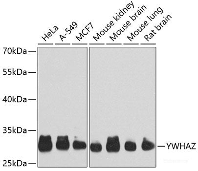 Immunofluorescence analysis of U2OS cells using PRMT6 Polyclonal Antibody at dilution of  1:100. Blue: DAPI for nuclear staining.