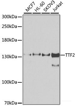 Immunohistochemistry of paraffin-embedded Human stomach using PSPH Polyclonal Antibody at dilution of  1:100 (40x lens).