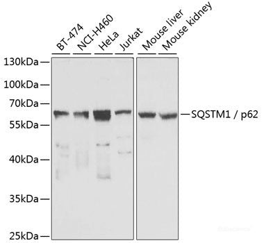 Immunohistochemistry of paraffin-embedded Mouse kidney using STX1A Polyclonal Antibody