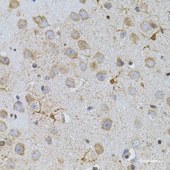 Immunofluorescence analysis of U2OS cells using TAF11 Polyclonal Antibody at dilution of  1:100. Blue: DAPI for nuclear staining.
