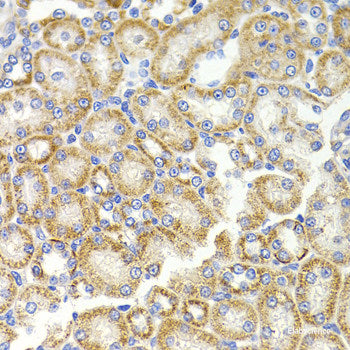 Immunofluorescence analysis of A549 cells using CAMK1D Polyclonal Antibody