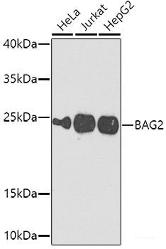 Immunohistochemistry of paraffin-embedded Rat heart using ADAM12 Polyclonal Antibody at dilution of  1:100 (40x lens).