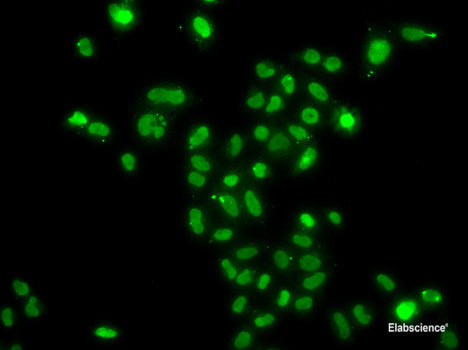 Immunohistochemistry of paraffin-embedded Mouse brain using CKAP4 Polyclonal Antibody
