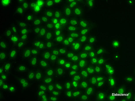 Western blot analysis of extracts of Mouse brain using TAF5 Polyclonal Antibody at dilution of 1:1000.