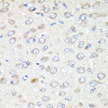 Immunohistochemistry of paraffin-embedded Mouse lung using KDM4A Polyclonal Antibody at dilution of  1:100 (40x lens).