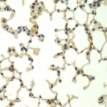 Immunohistochemistry of paraffin-embedded Mouse heart using MTX2 Polyclonal Antibody at dilution of  1:100 (40x lens).