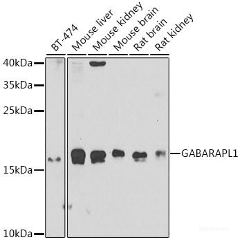 Immunofluorescence analysis of A549 cells using MTHFD1L Polyclonal Antibody