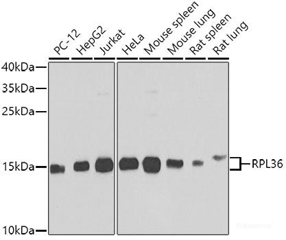 Immunohistochemistry of paraffin-embedded Human stomach using B9D1 Polyclonal Antibody at dilution of  1:100 (40x lens).