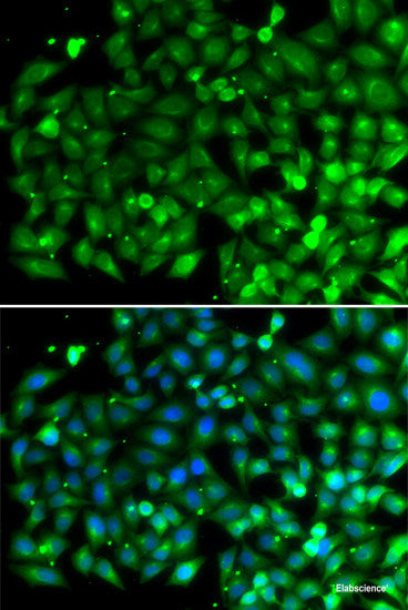 Immunofluorescence analysis of MCF-7 cells using ING5 Polyclonal Antibody