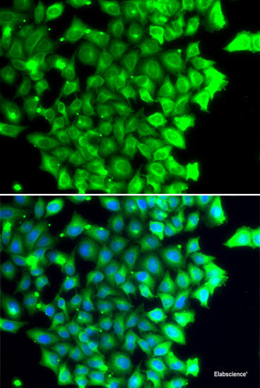 Immunofluorescence analysis of A549 cells using RAC3 Polyclonal Antibody