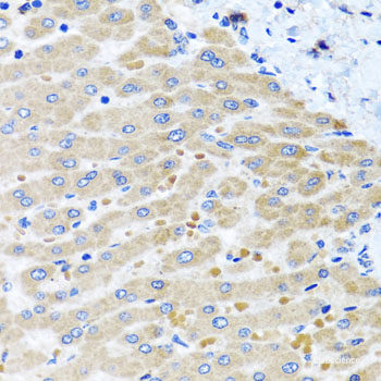 Immunohistochemistry of paraffin-embedded Mouse brain using ASAH2 Polyclonal Antibody