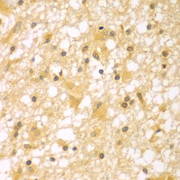 Immunohistochemistry of paraffin-embedded Human prostate using MCCC2 Polyclonal Antibody at dilution of  1:100 (40x lens).