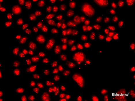 Immunohistochemistry of paraffin-embedded Mouse lung using FBXW11 Polyclonal Antibody at dilution of  1:100 (40x lens).