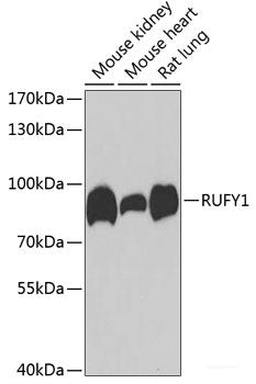 Immunofluorescence analysis of U2OS cells using SOCS4 Polyclonal Antibody at dilution of  1:100. Blue: DAPI for nuclear staining.