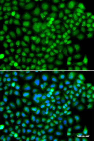 Western blot analysis of extracts of various cell lines using SULT2B1 Polyclonal Antibody at dilution of 1:1000.