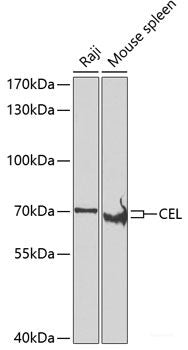 Immunohistochemistry of paraffin-embedded Rat brain using RAB17 Polyclonal Antibody at dilution of  1:100 (40x lens).