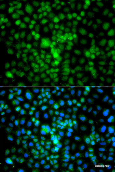 Immunofluorescence analysis of A549 cells using TSEN2 Polyclonal Antibody