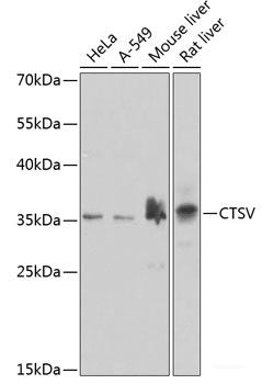 Immunofluorescence analysis of U2OS cells using ATG4D Polyclonal Antibody at dilution of  1:100. Blue: DAPI for nuclear staining.