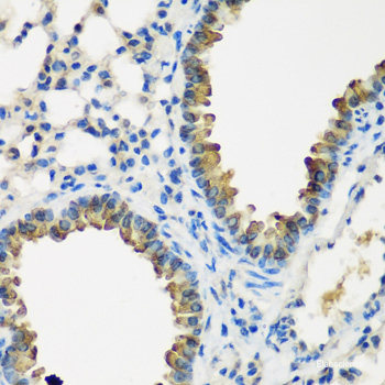 Immunohistochemistry of paraffin-embedded Human tonsil using PLA2G4C Polyclonal Antibody at dilution of  1:100 (40x lens).